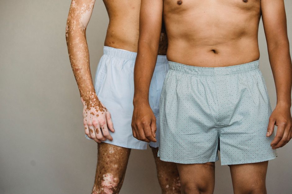 Crop anonymous shirtless man with vitiligo skin standing behind male with naked torso against gray wall in studio during photo session